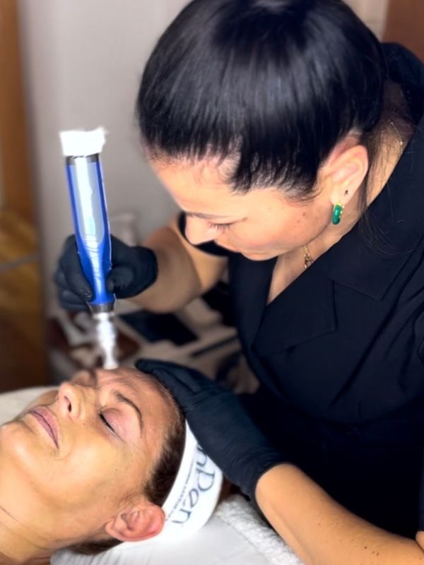 Microneedling with Angel Therapies in London - image of lady with eyes shut lying on couch having microneedling session