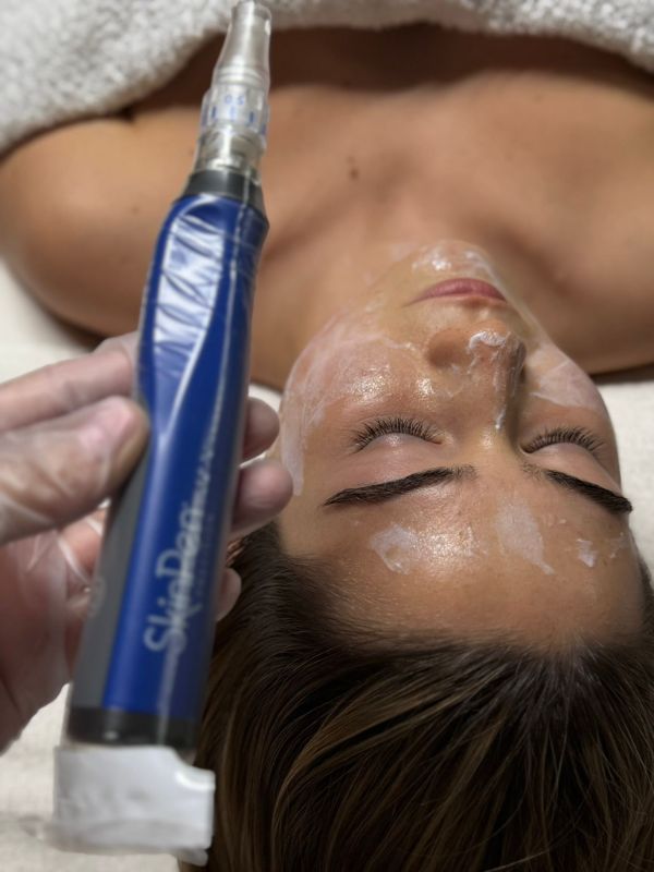 Microneedling with Angel Therapies in London - image of lady with eyes shut lying on couch having microneedling session