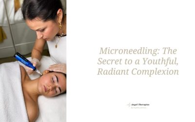 Microneedling: The Secret to a Youthful, Radiant Complexion