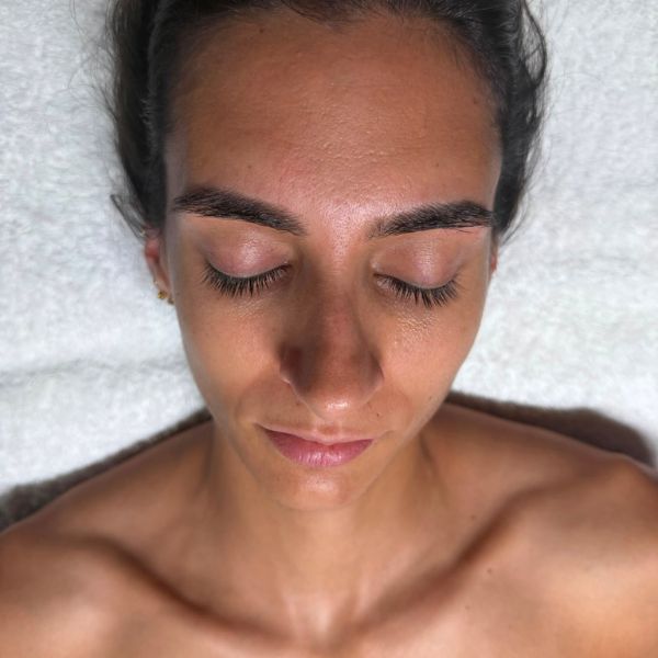 microcurrent & ultrasound facial - before - angel therapies - london